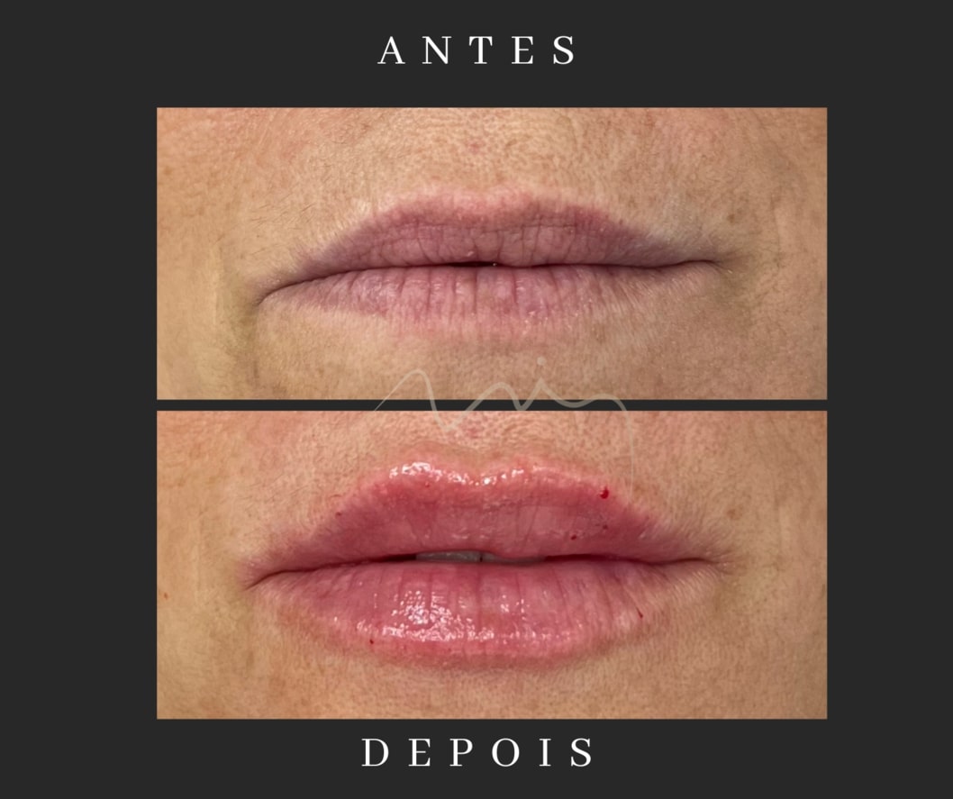 Labios 3