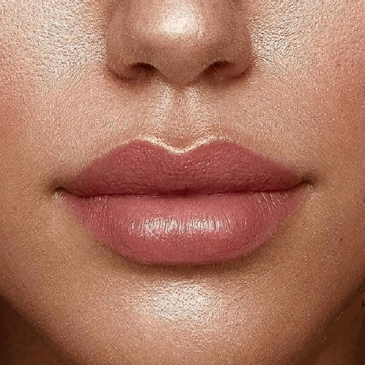 liplift